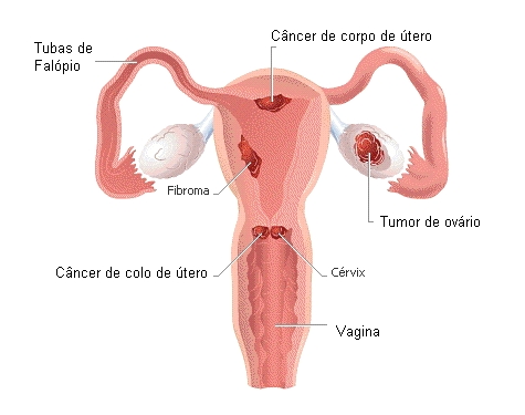 Localizao do cncer